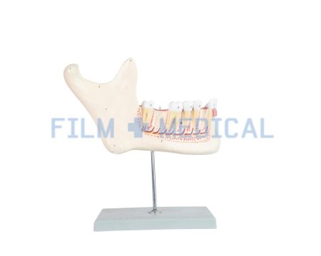Jaw Model 